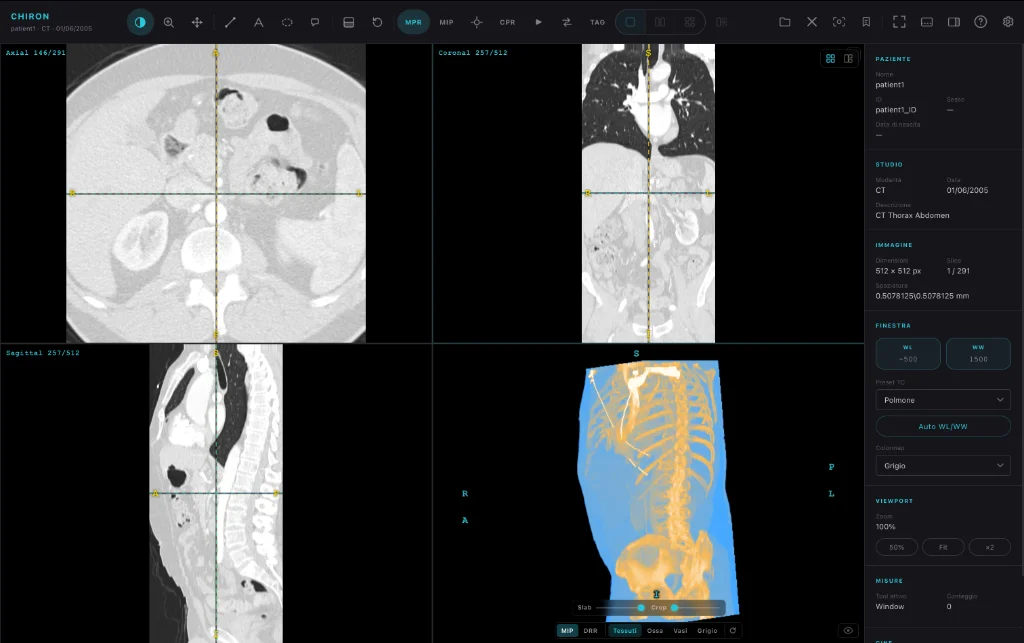MPR e rendering 3D in Chiron
