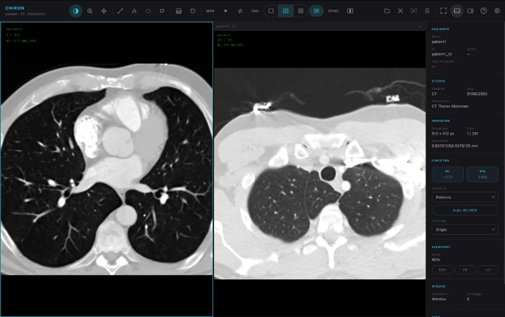 Confronto multi-viewport in Chiron